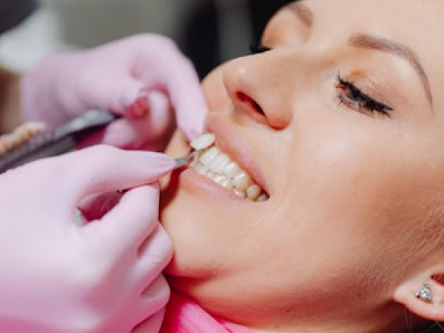 What Are the Differences Between Dental Crowns and Bridges? Let’s Explore