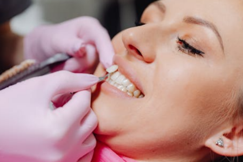 Young woman receiving professional whitening treatment from a dentist