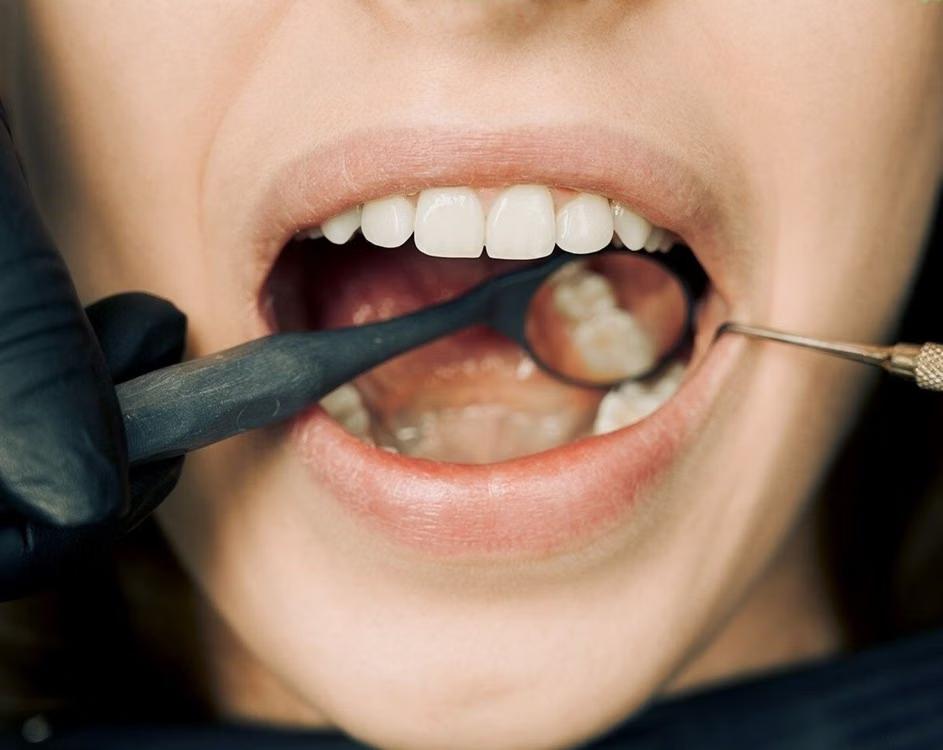 a person getting a dental checkup.