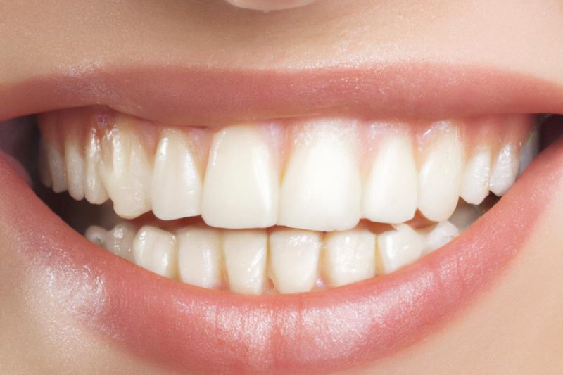 A close-up of a person smiling with their teeth visible.