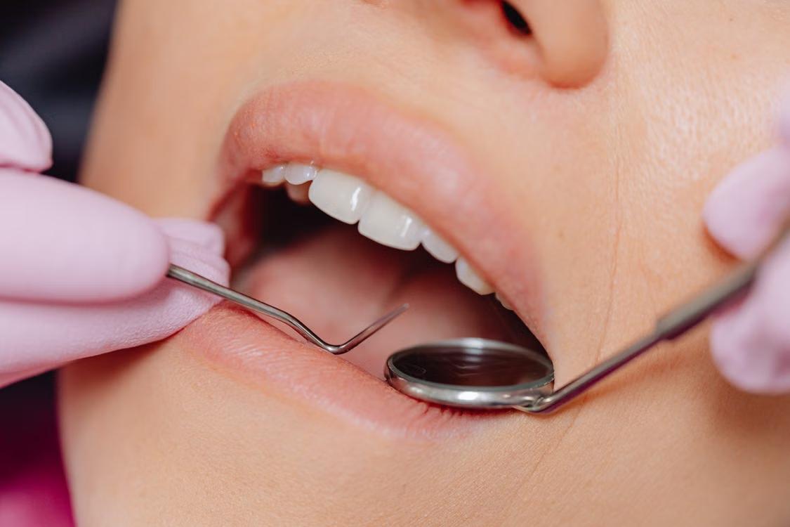 a patient undergoing a dental procedure.